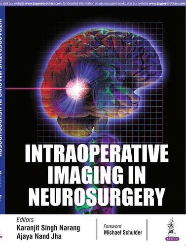 Intraoperative Imaging in Neurosurgery-zoom-