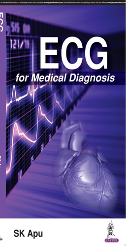 ECG for Medical Diagnosis