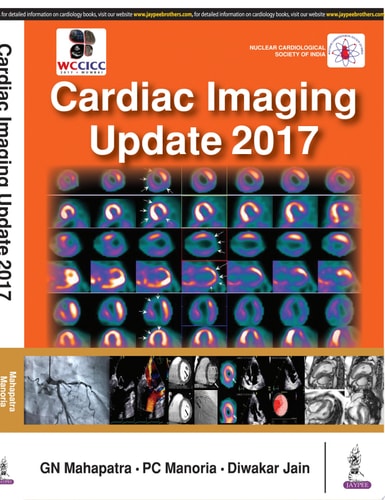 Cardiac Imaging Update 2017