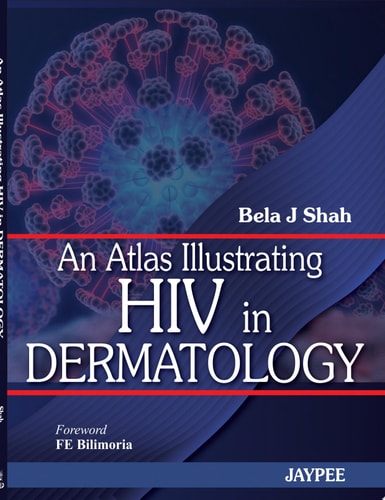 An Atlas Illustrating HIV in Dermatology