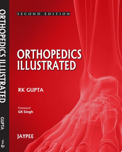 Orthopedics Illustrated