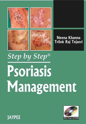 Step by Step® Psoriasis Management