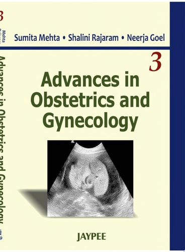 Advances in Obstetrics and Gynecology (Vol. 3)