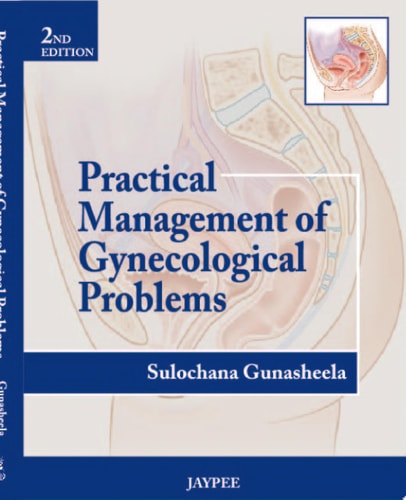 Practical Management of Gynecological Problems