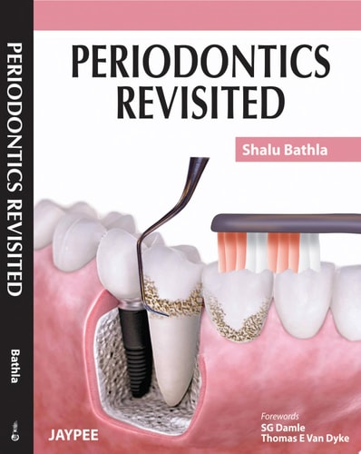 Periodontics Revisited-zoom-