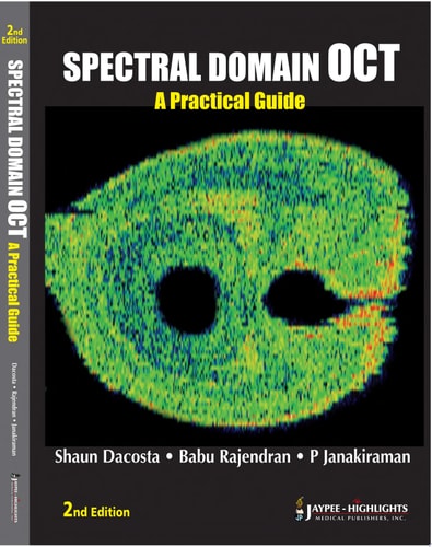 Spectral Domain Optical Coherence Tomography: A Practical Guide