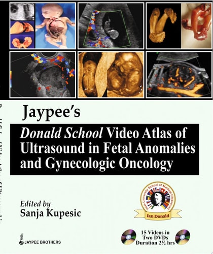 Jaypee's Donald School Video Atlas of Ultrasound in Fetal Anomalies and Gynecologic Oncology