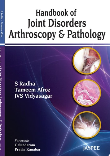 Handbook of Joint Disorders Arthroscopy & Pathology