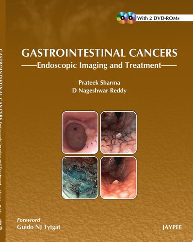 Gastrointestinal Cancers: Endoscopic Imaging and Treatment