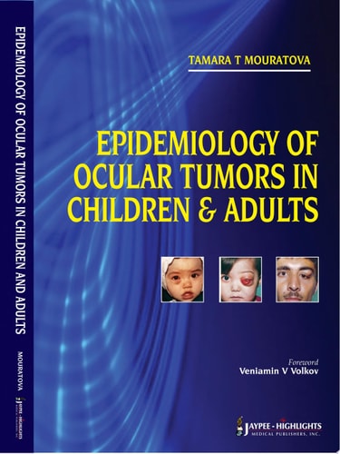 Epidemiology of Ocular Tumors in Children & Adults-zoom-