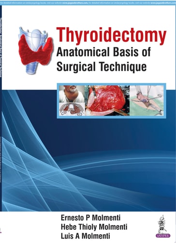 Thyroidectomy Anatomical Basis of Surgical Technique