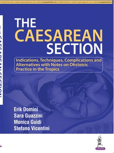 The Caesarean Section-zoom-