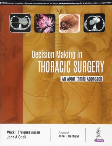 Decision Making in Thoracic Surgery An Algorithmic Approach