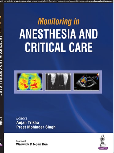 Monitoring in Anesthesia and Critical Care-1