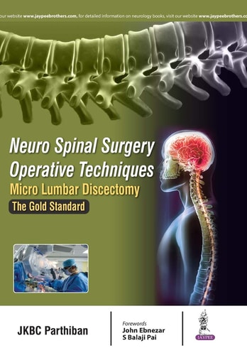 Neuro Spinal Surgery Operative Techniques: Micro Lumbar Discectomy The Gold Standard