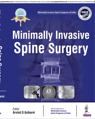 Minimally Invasive Spine Surgery-zoom-1