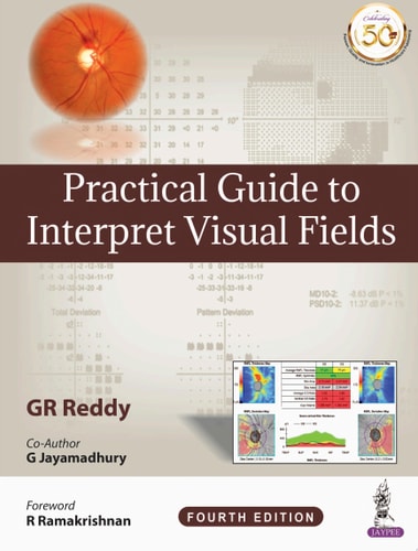 Practical Guide to Interpret Visual Fields