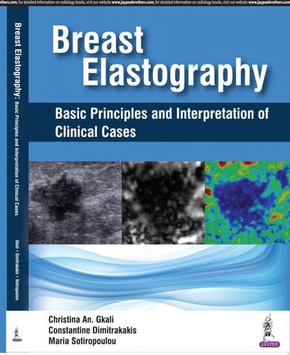 Breast Elastography Basic Principles and Interpretation of Clinical Cases-zoom-1