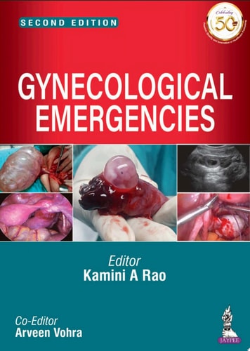 Gynecological Emergencies