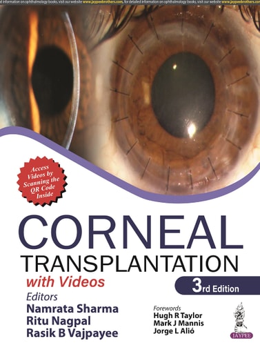 Corneal Transplantation With Videos