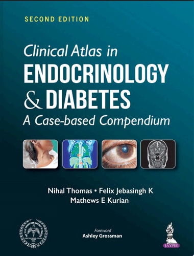 Clinical Atlas in Endocrinology and Diabetes A Case-based Compendium