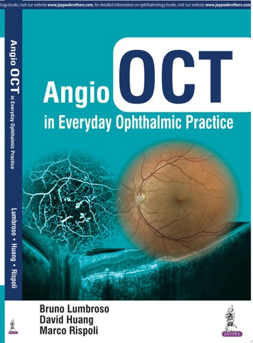 Angio OCT in Everyday Ophthalmic Practice-zoom-