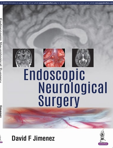 Endoscopic Neurological Surgery-1