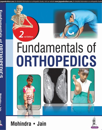 Fundamentals of Orthopedics-1