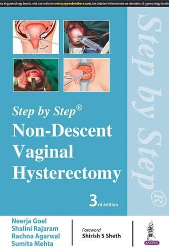 Step by Step: Non-Descent Vaginal Hysterectomy-zoom-1