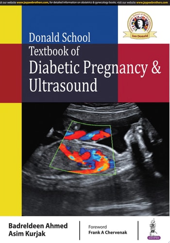 Donald School Textbook of Diabetic Pregnancy & Ultrasound-zoom-