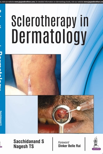 Sclerotherapy in Dermatology-zoom-1