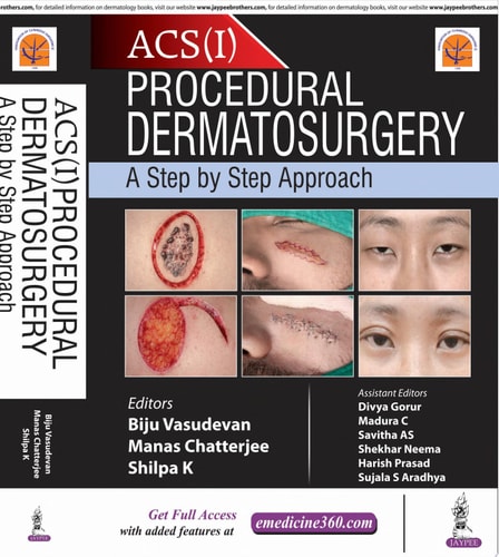 Procedural Dermatosurgery A Step by Step Approach-zoom-