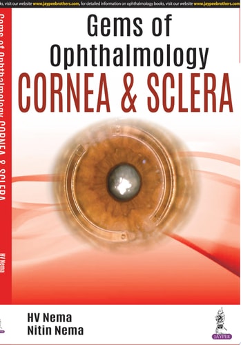 Gems of Ophthalmology: Cornea & Sclera-zoom-