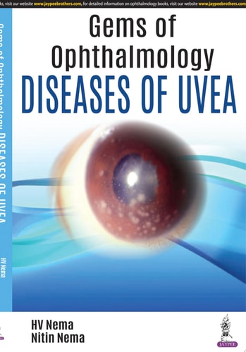 Gems of Ophthalmology: Diseases of Uvea-1