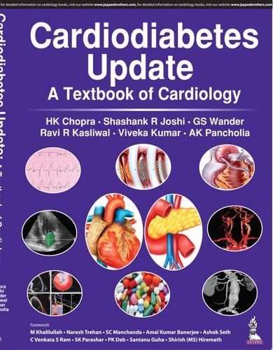 Cardiodiabetes Update A Textbook of Cardiology