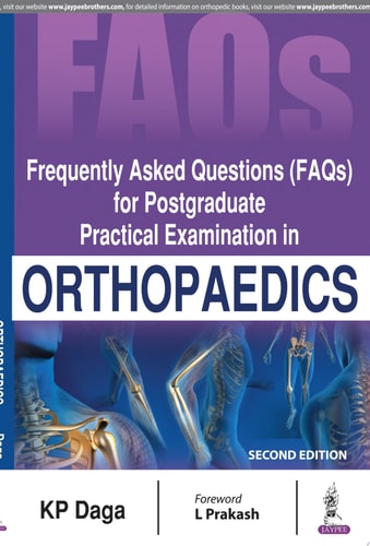 Frequently Asked Questions (FAQs) for Postgraduate Practical Examination in Orthopaedics-1