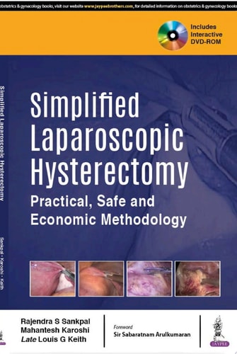 Simplified Laparoscopic Hysterectomy Practical, Safe and Economic Methodology-zoom-1