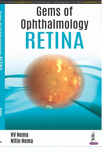 Gems of Ophthalmology: Retina
