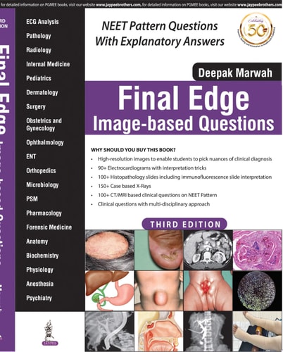 Final Edge Image-based Questions