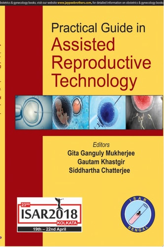 Practical Guide in Assisted Reproductive Technology