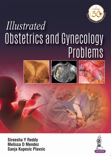 Illustrated Obstetrics and Gynecology Problems
