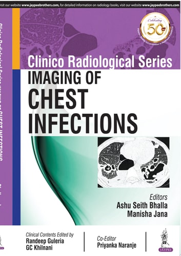 Clinico Radiological Series: Imaging of Chest Infections