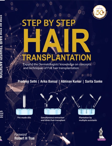Step by Step Hair Transplantation