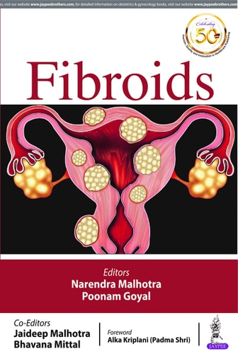 FIBROIDS-1
