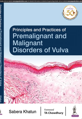 Principles and Practice of Premalignant and Malignant Disorders of Vulva
