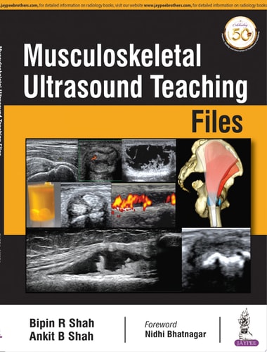 Musculoskeletal Ultrasound Teaching Files