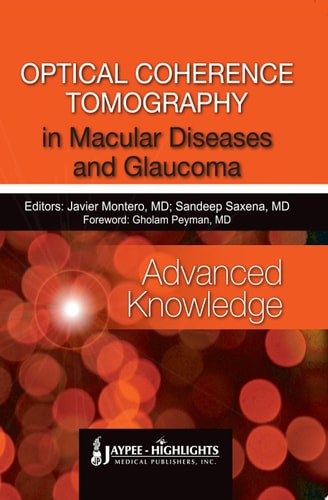 Optical Coherence Tomography in Macular Diseases and Glaucoma—Advanced Knowledge
