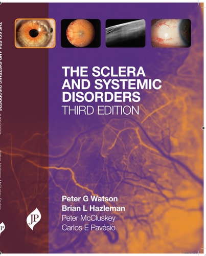 The Sclera and Systemic Disorders