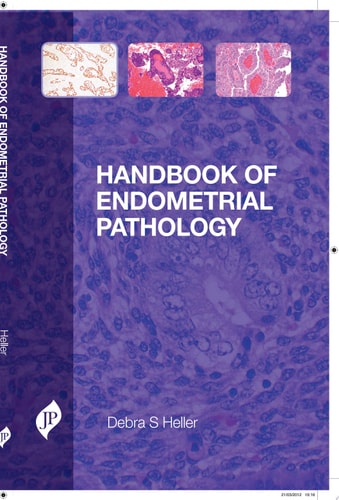 Handbook of Endometrial Pathology-zoom-1