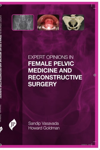 Expert Opinions in Female Pelvic Medicine and Reconstructive Surgery